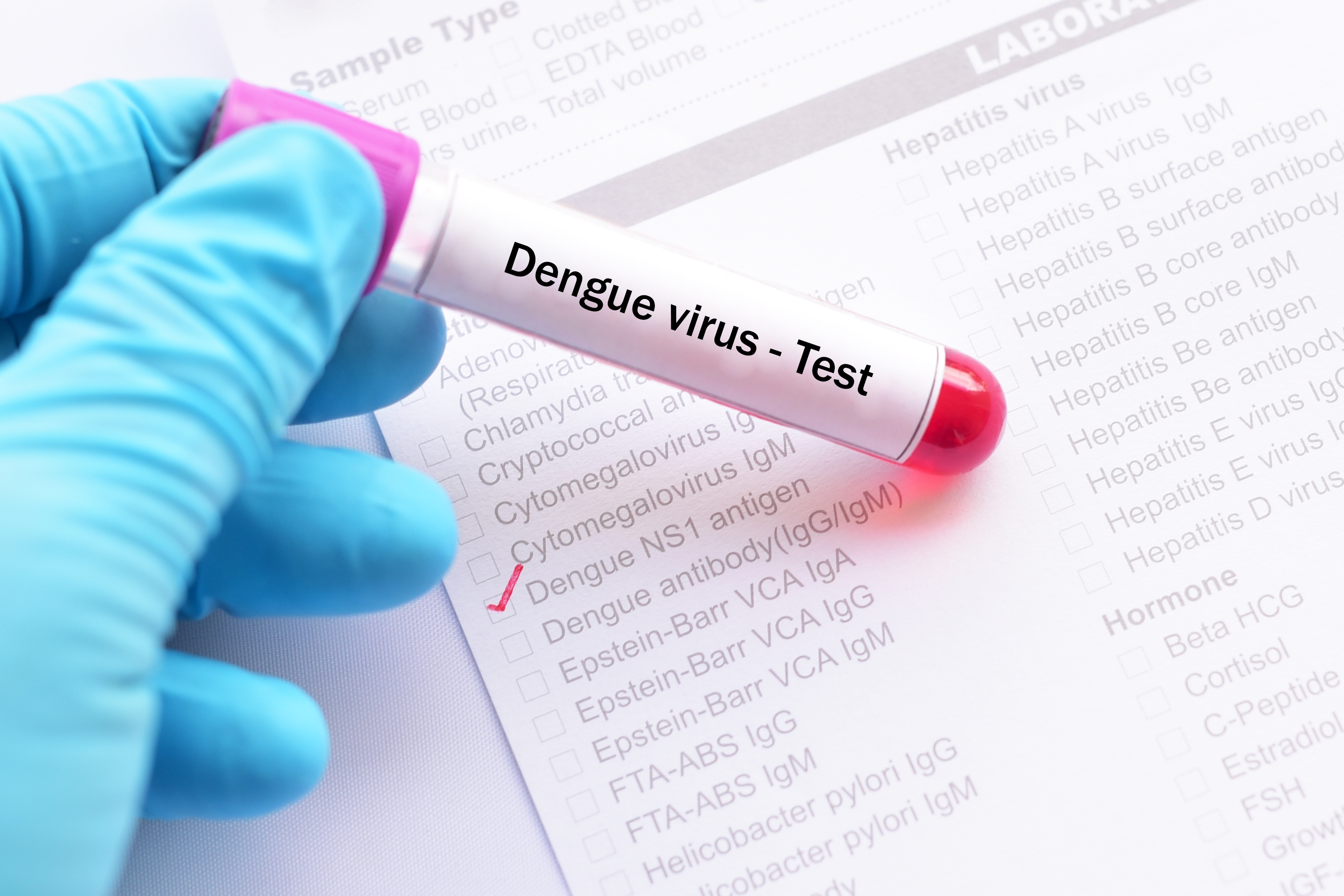 Dengue Tests